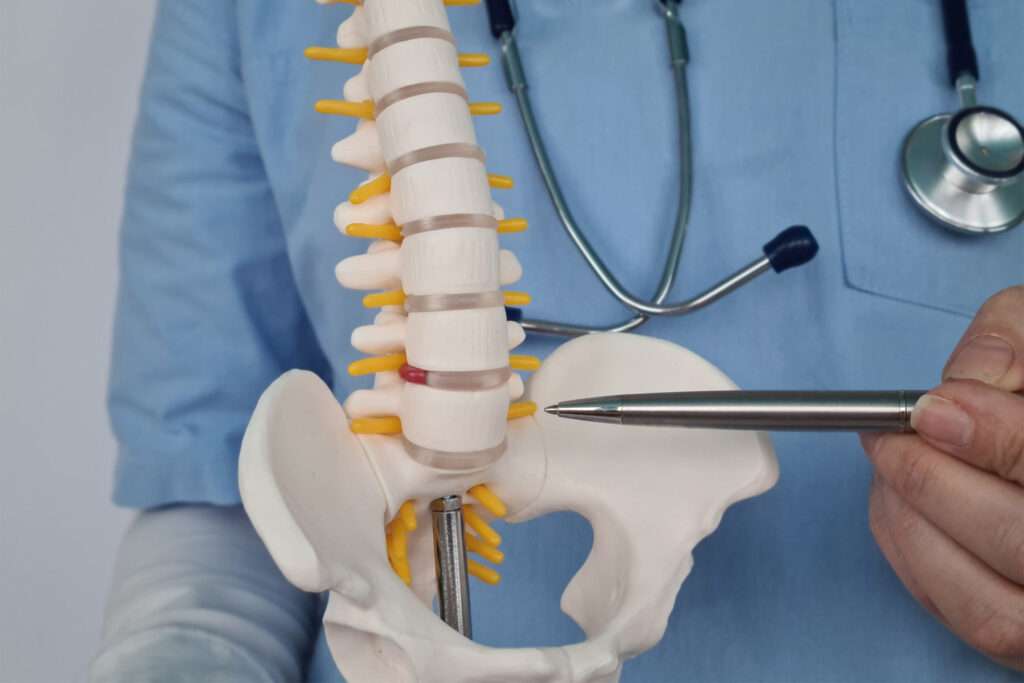 Choosing the Right Spine Doctor for Your Condition