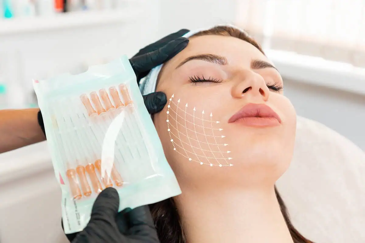 How Microneedling Transforms Your Complexion