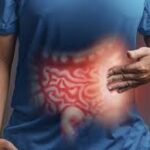 How Ulcerative Colitis Affects Your Daily Life and How to Cope