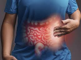How Ulcerative Colitis Affects Your Daily Life and How to Cope