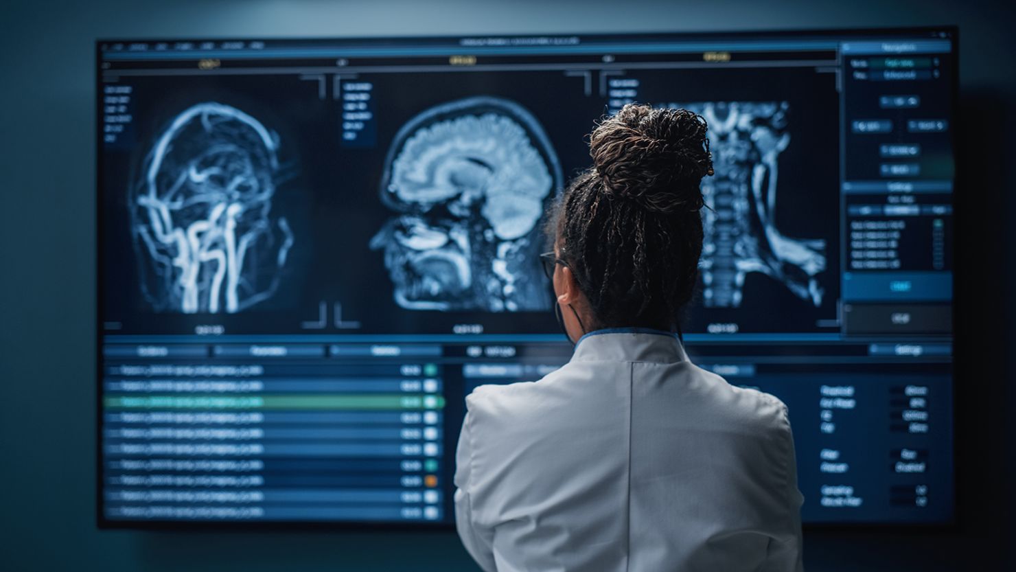 Can Athletes Prevent Long-Term Head Injury Effects?
