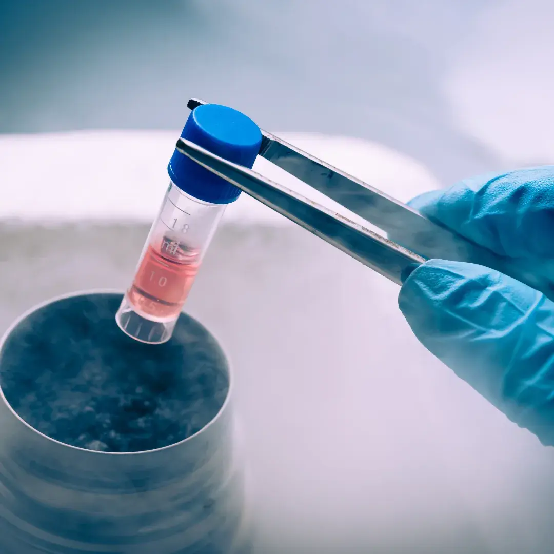 Common Questions About Stem Cell Therapy