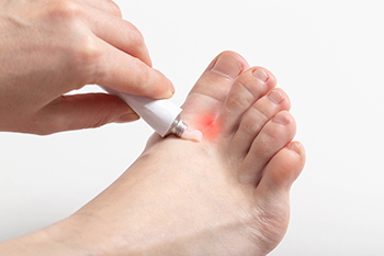How Bunions Are Diagnosed and Treated by Foot Specialists