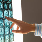 How MRI Technology Enhances the Diagnosis of Soft Tissue Injuries