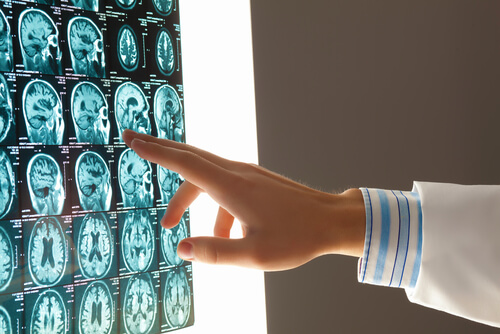 How MRI Technology Enhances the Diagnosis of Soft Tissue Injuries