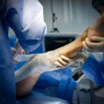 How to Find the Right Surgeon for Foot and Ankle Surgery