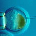 Signs You Should Try In Vitro Fertilization