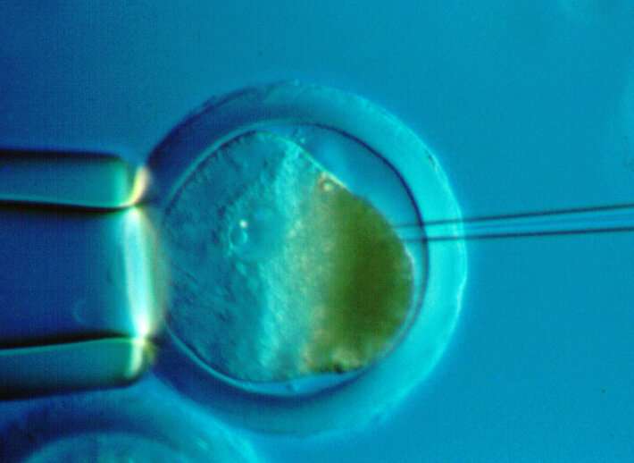 Signs You Should Try In Vitro Fertilization