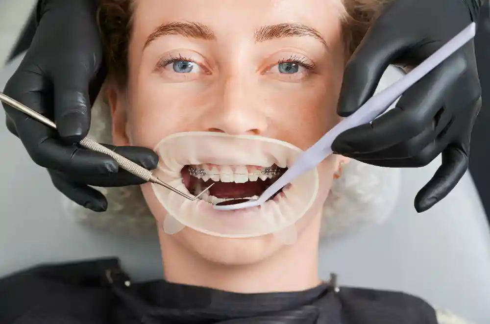 The Benefits of Tooth Extraction for Better Oral Hygiene