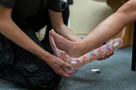 The Comprehensive Care Provided by Foot and Ankle Specialists