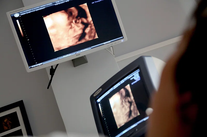 The Role of Ultrasound in Early Pregnancy Care
