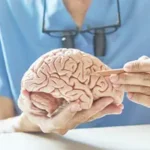5 Questions To Ask Your Neurologist