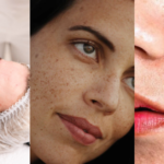 Can Laser Genesis Help with Skin Firmness and Texture?