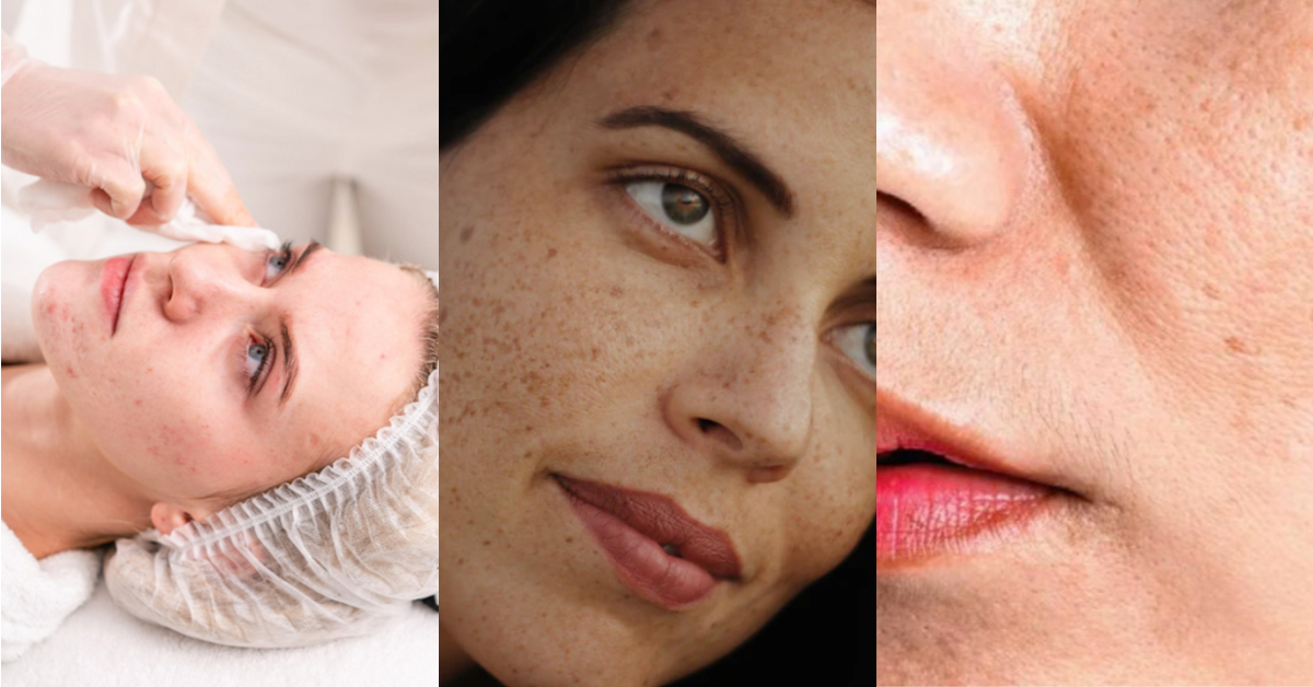 Can Laser Genesis Help with Skin Firmness and Texture?