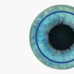 How Lasik Surgery Can Transform Your Vision