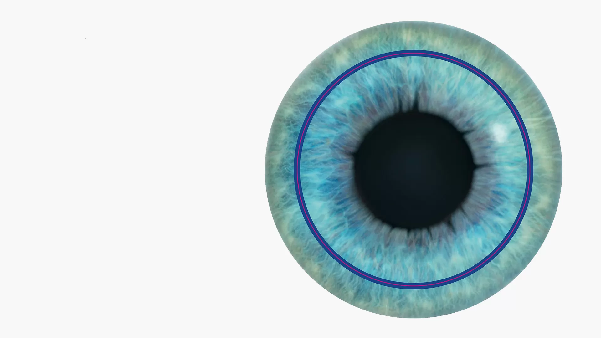 How Lasik Surgery Can Transform Your Vision