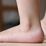How Podiatry Can Help With Flat Feet and Fallen Arches