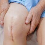 How Total Joint Replacement Can Restore Mobility