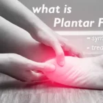 How a Foot Specialist Can Help You Manage Plantar Fasciitis