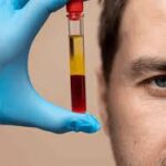 PRP Injections for Joint Pain: A Non-surgical Treatment Option