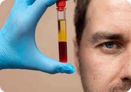 PRP Injections for Joint Pain: A Non-surgical Treatment Option
