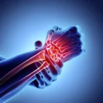Strategies for Treating Joint Pain and Improving Mobility