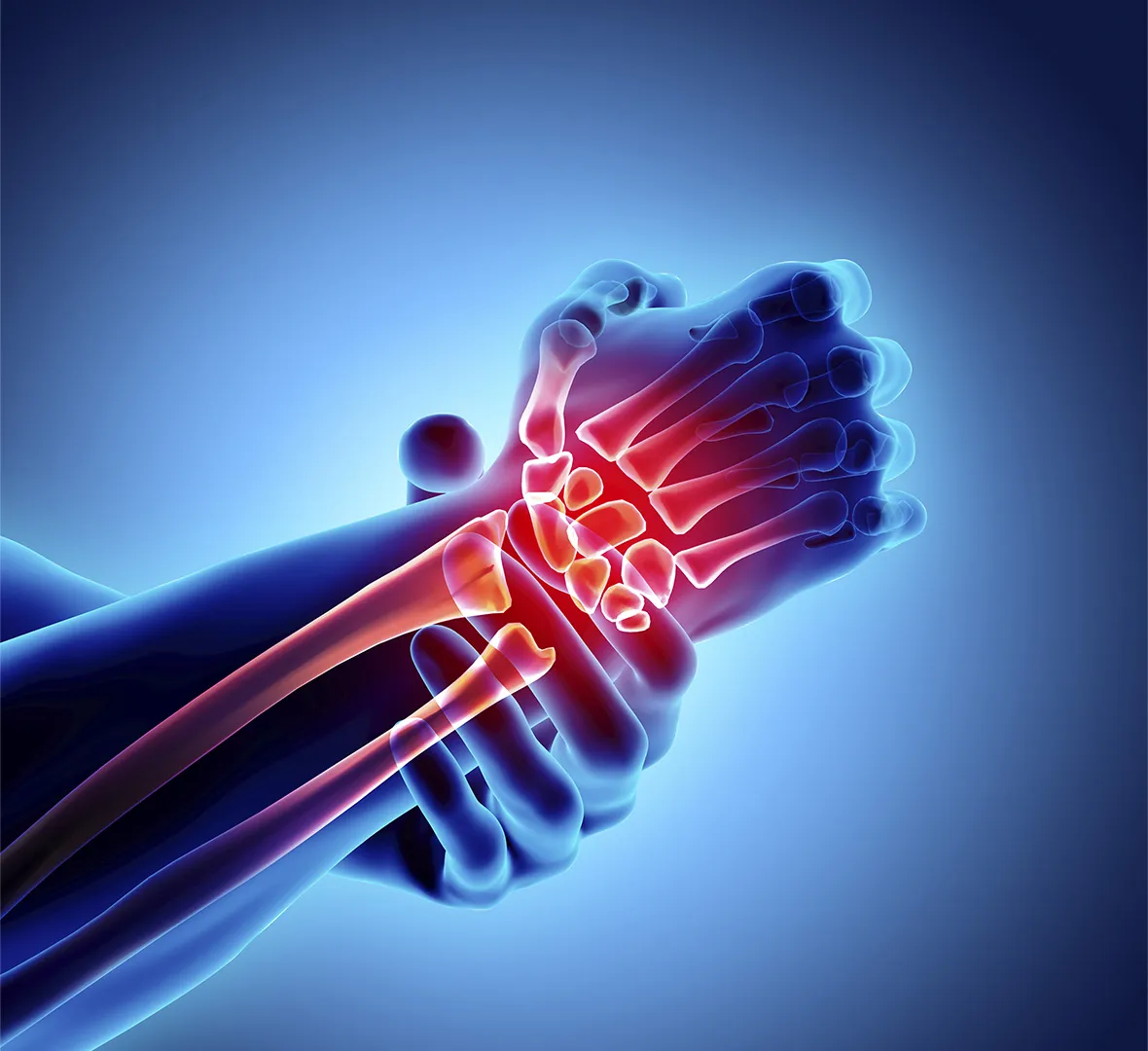 Strategies for Treating Joint Pain and Improving Mobility