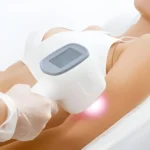 Tips for Laser Hair Removal Aftercare