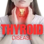 Understanding the Risks and Benefits of Thyroid Surgery