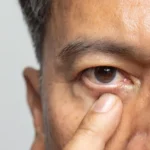 Understanding the Expertise of Ophthalmologists in Eye Health