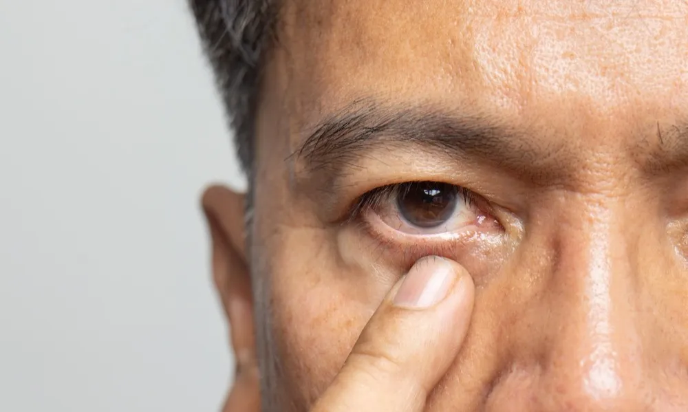 Understanding the Expertise of Ophthalmologists in Eye Health