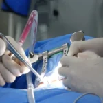 Robotic Assisted Joint Replacement Explained