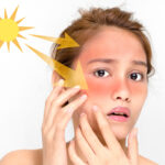The Connection Between Sun Exposure and Skin Cancer Risk