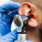 Exploring the Benefits of Hearing Implants for Severe Hearing Loss