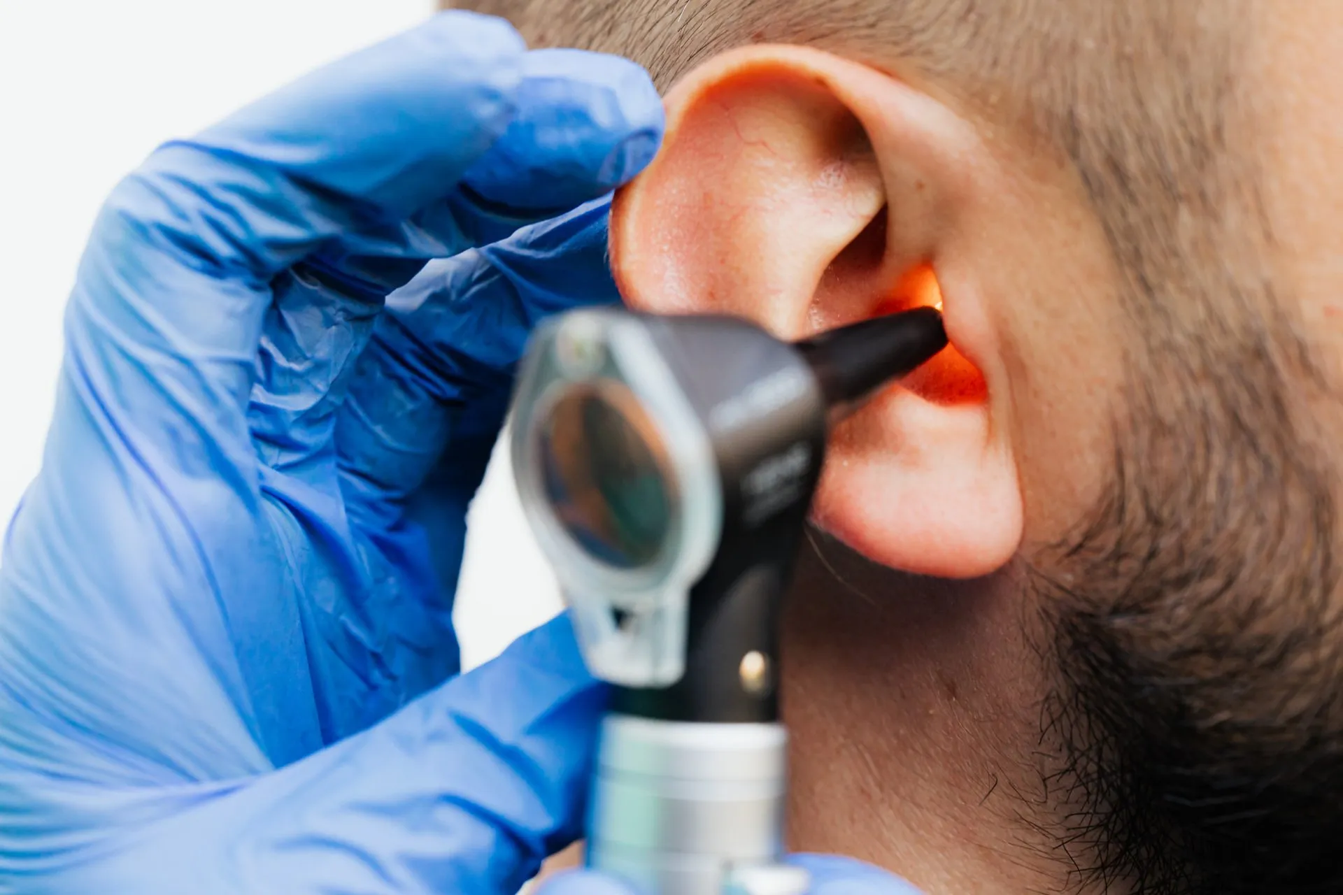 Exploring the Benefits of Hearing Implants for Severe Hearing Loss