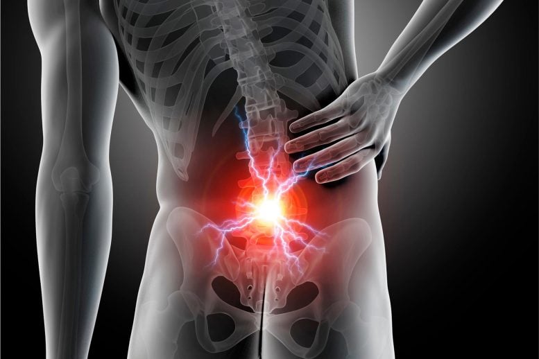 How Spinal Cord Stimulation Can Help Manage Chronic Pain