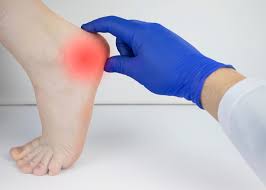Understanding the Common Causes and Treatments for Heel Pain