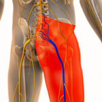Remedies for Managing Sciatica Symptoms