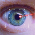 Is LASIK Surgery Right for You? Benefits, Risks, and Expectations