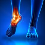 How Ankle Sprains Can Lead to Long-term Joint Issues