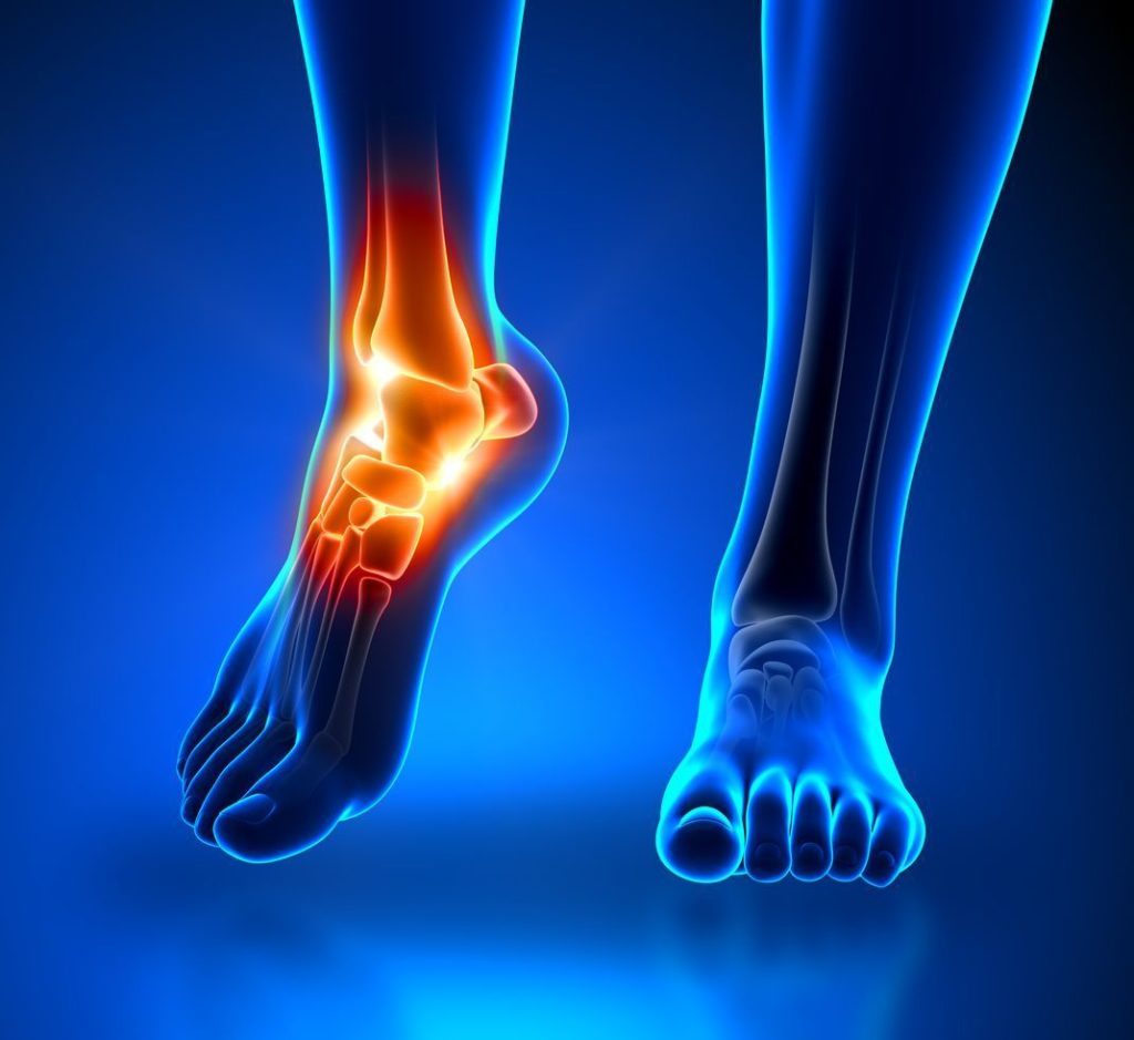 How Ankle Sprains Can Lead to Long-term Joint Issues