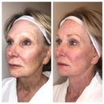 How Anti-Aging Treatments Support Youthful Skin