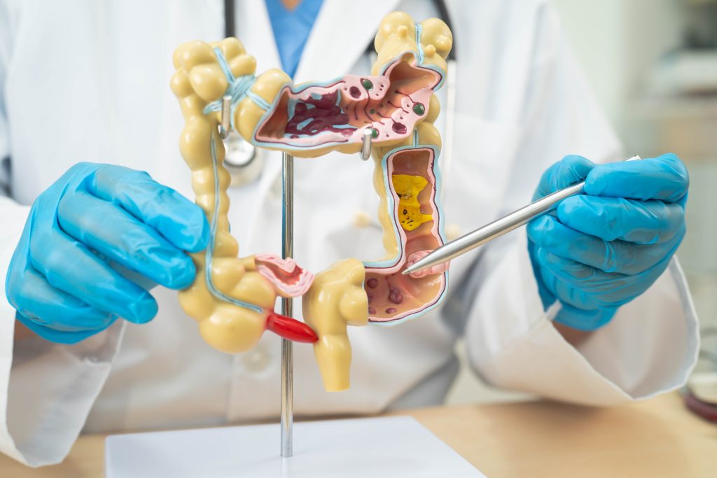 How Gastroenterologists Diagnose Digestive Disorders