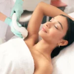 How To Prepare for Laser Hair Removal