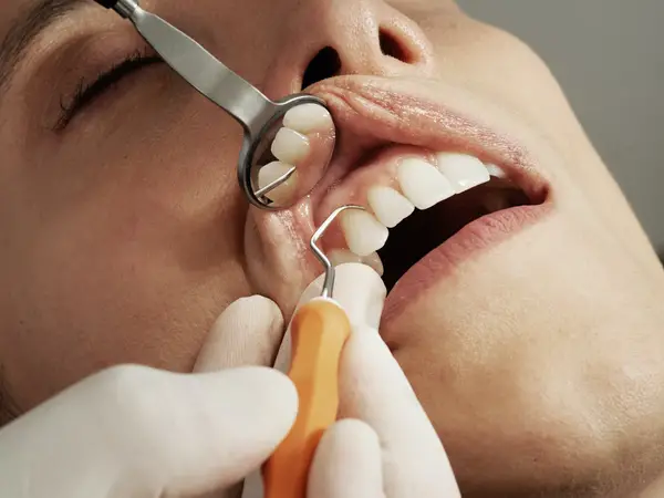 How Will a Dentist Help With Preventive Care?