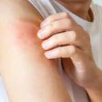 Issues a Dermatologist can Help With