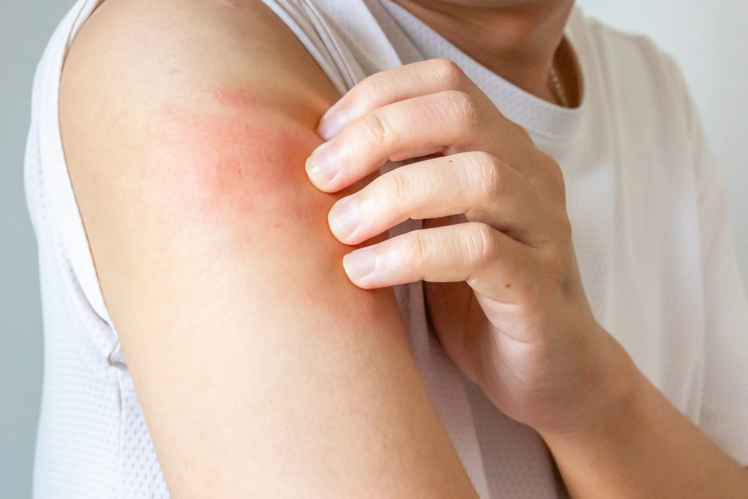 Issues a Dermatologist can Help With