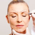 The Art of Facial Aesthetics by a Plastic Surgeon