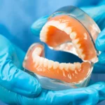 The Role of Regular Check-Ups for Your Dentures