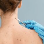 Types of Skin Cancer Services Available to Patients
